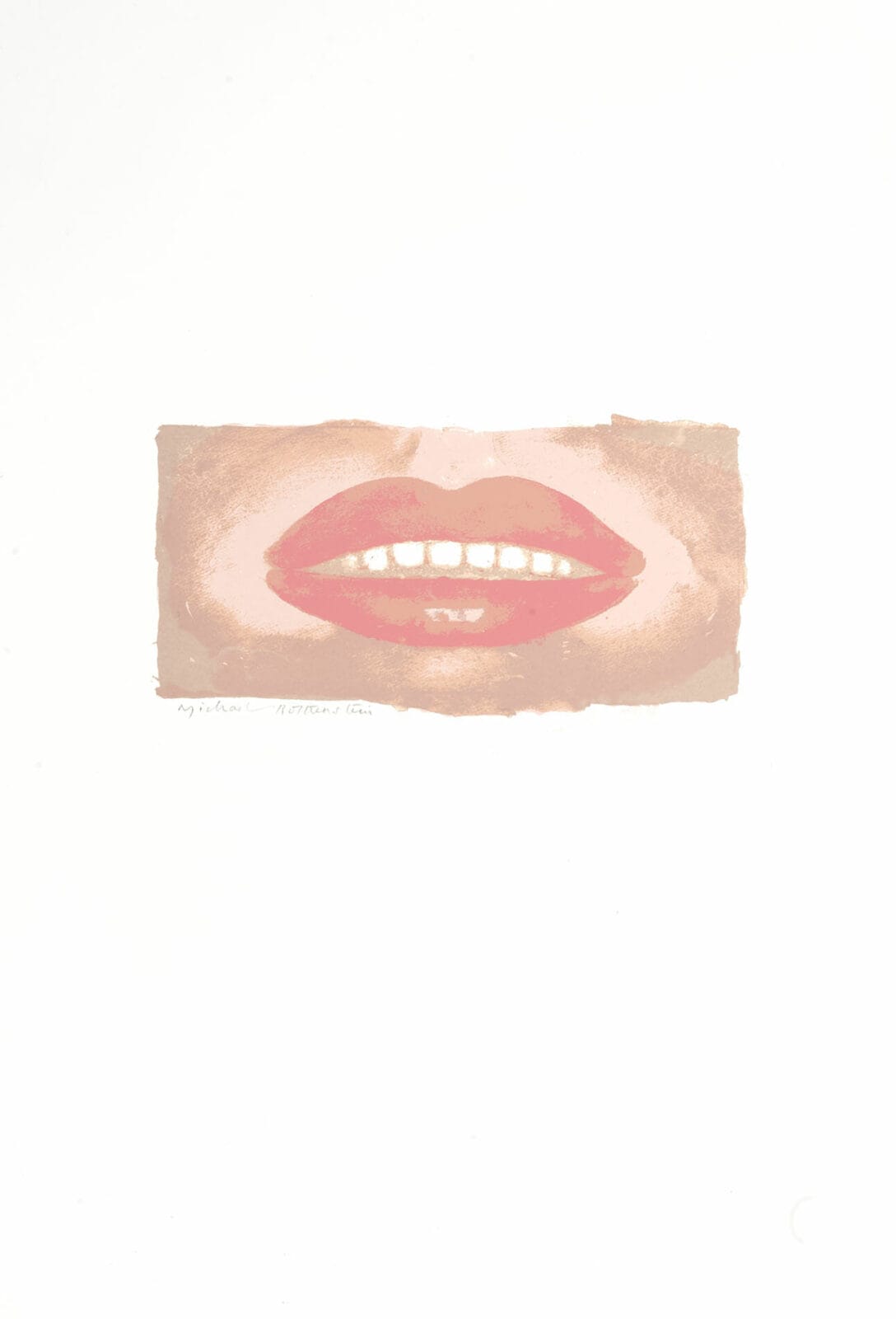 Lithograph illustration in a rectangle shape, showing slightly parted pink lips, revealing teeth. The skin is lighter and uneven in tone.