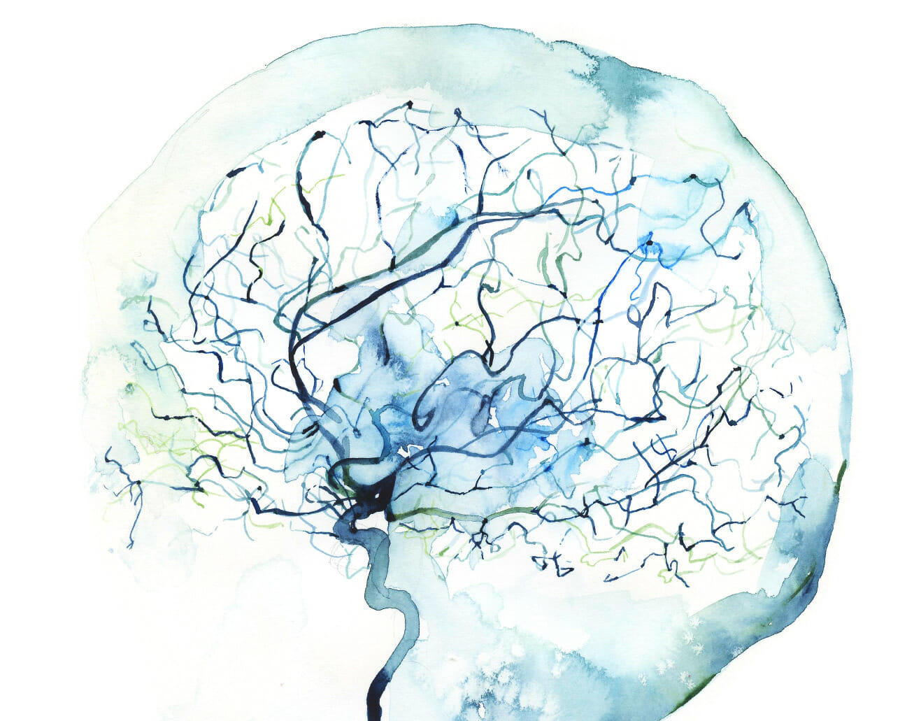 Watercolor painting depicting a cerebral angiogram.